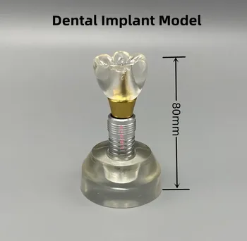 1шт Новых обучающих моделей на базе зубной коронки с одним зубом Arcylic Typodont Implant Study Модель зубов